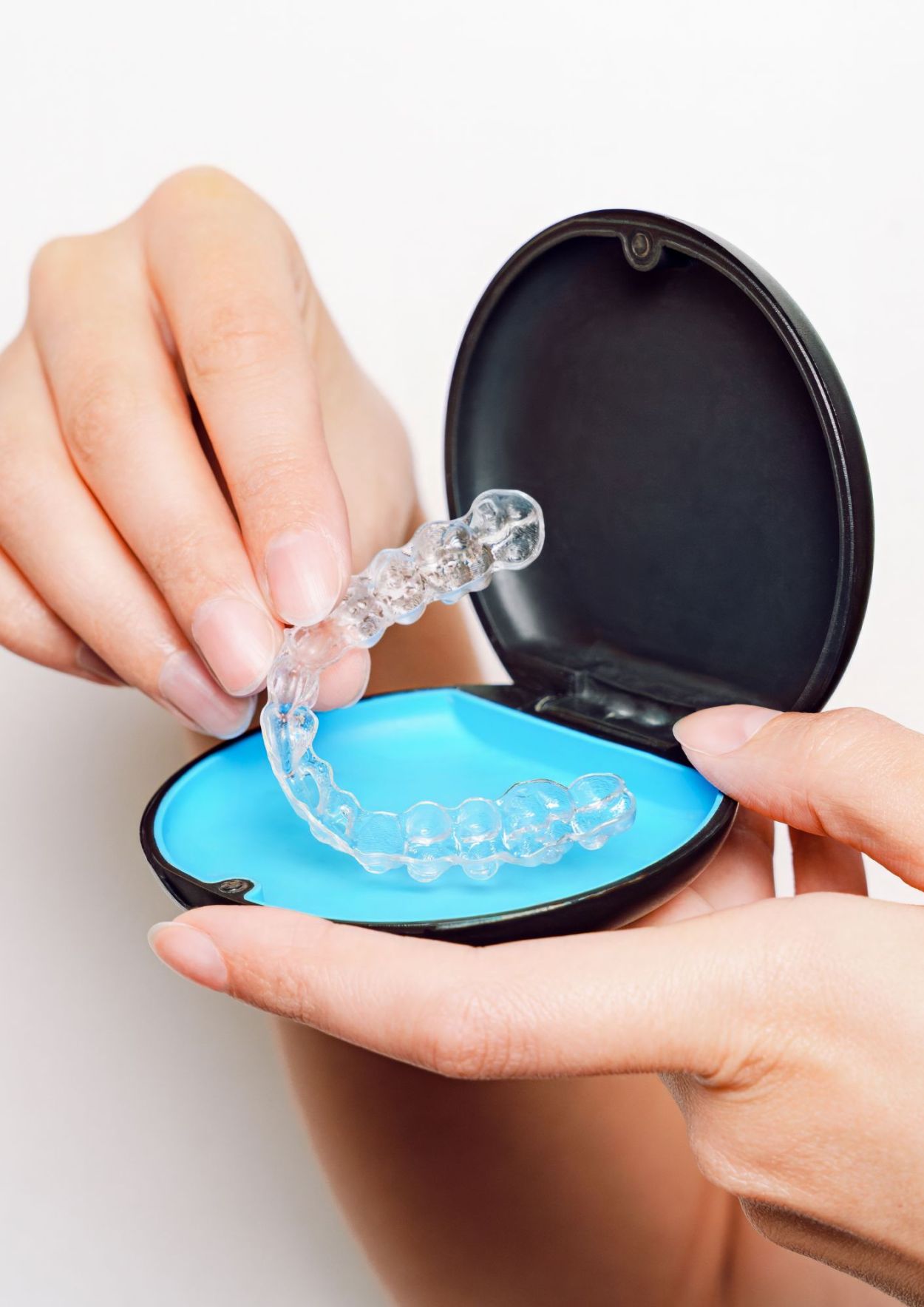 invisalign smartee