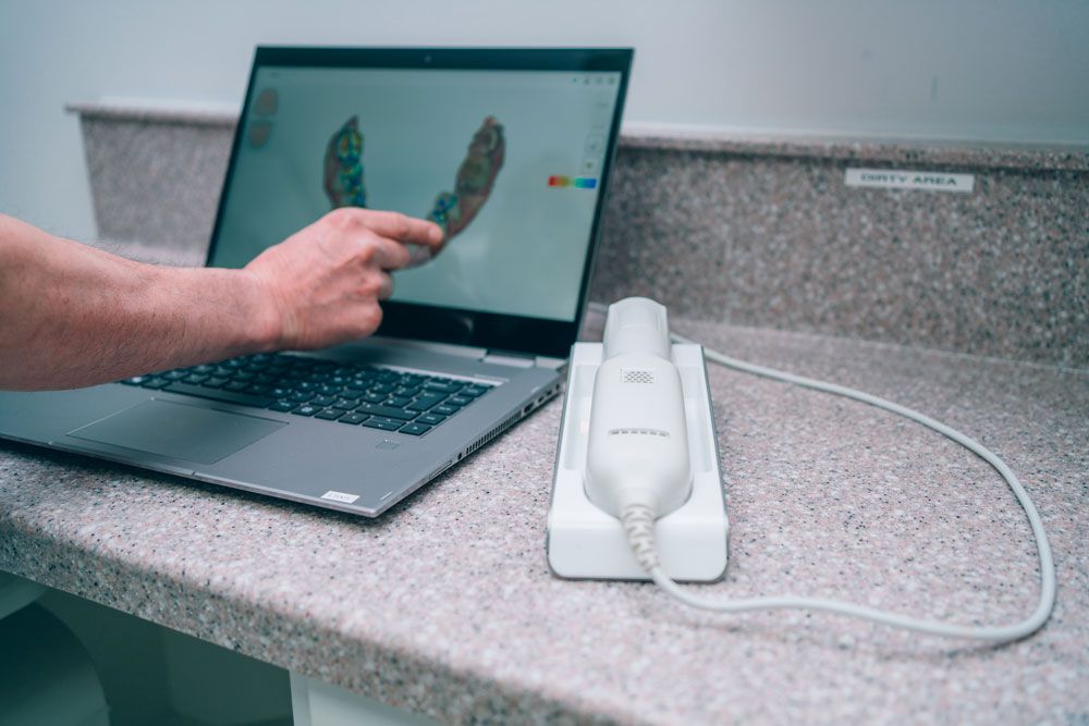 digital-scanner
